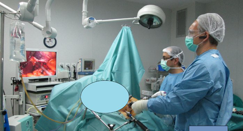 Bariatric Proceduri de pierdere în greutate Chirurgie