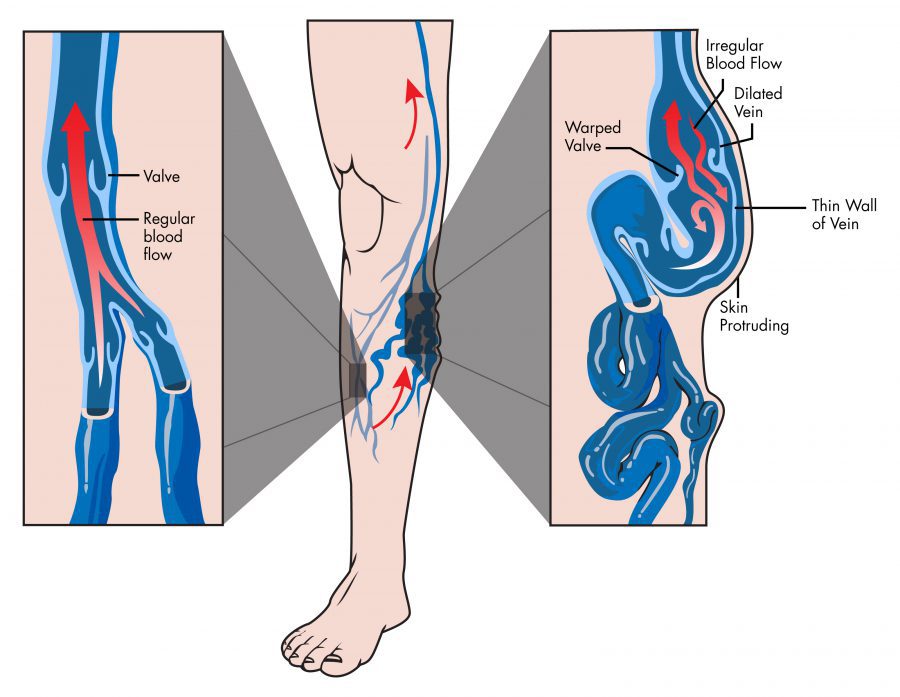 ligatura articulației genunchiului